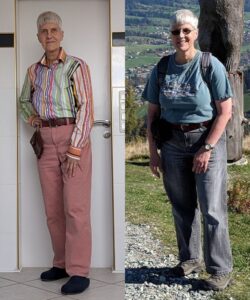 after and before 20kg weight loss